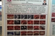 市口腔医院种植中心病例参展全国BITC口腔种植大奖赛壁报展评