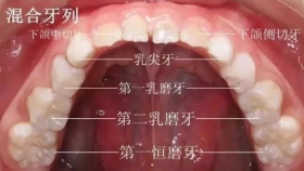 六龄牙终生不换，爸爸妈妈知道吗?