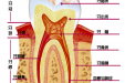 龋齿的分类
