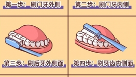 牙周健康指导