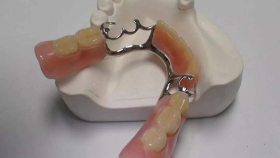 活动假牙真的会“弄坏”自己的“好牙”吗？
