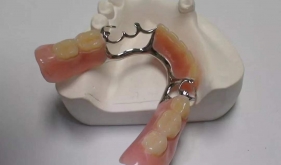 活動假牙真的會“弄壞”自己的“好牙”嗎？