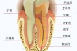 牙齿的“保髓”治疗