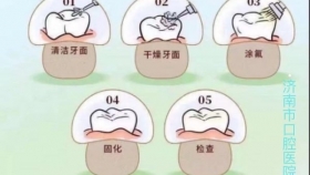 涂氟--给牙齿穿上“防护衣”