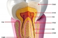 牙齿为什么会酸痛？