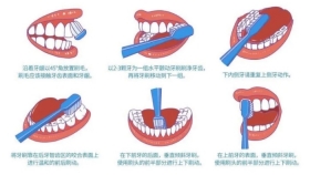 有效的刷牙-巴氏刷牙法