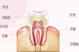 警惕！牙痛中的“王者”—牙髓炎！