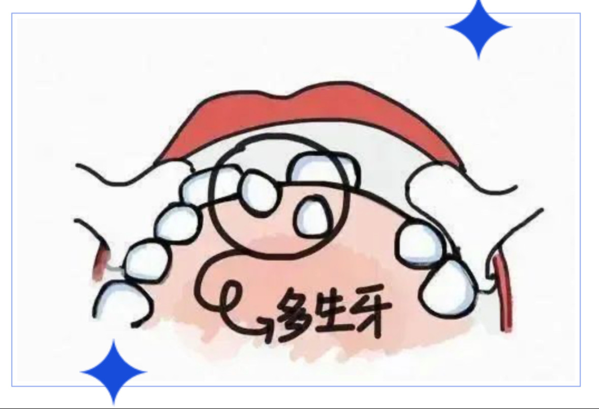 21e82255_38a9_49f0_bd8a_b3ab7f